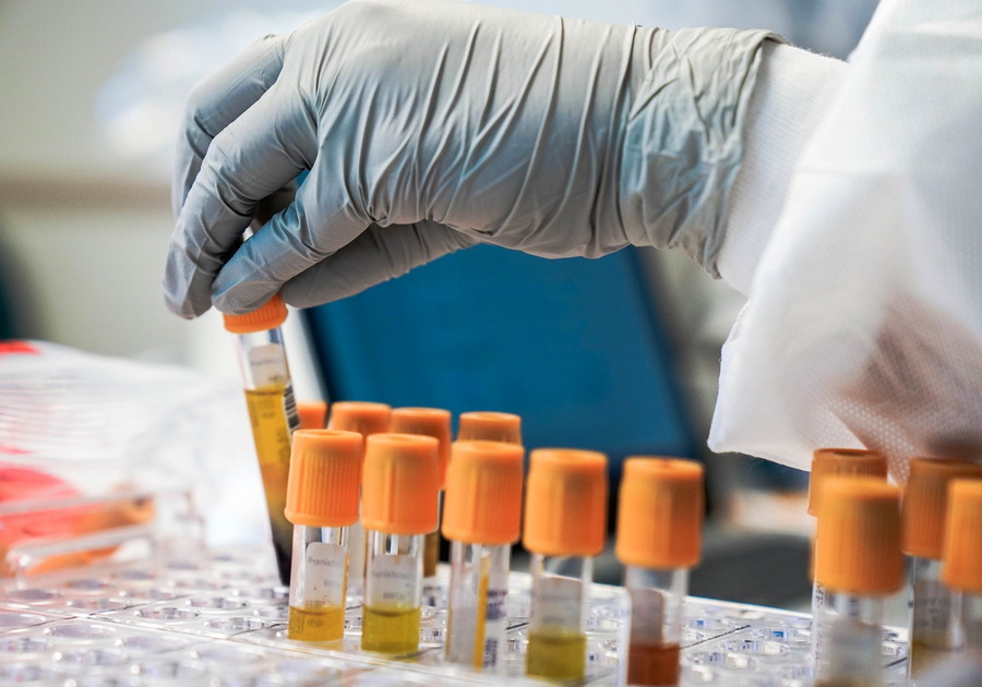 Rată uriașă de pozitivare a testelor Covid în Bihor: mai mult de 4 din 10 au indicat infectarea în ultima zi. În Sântandrei, aproape 4% din locuitori au SARS-CoV-2